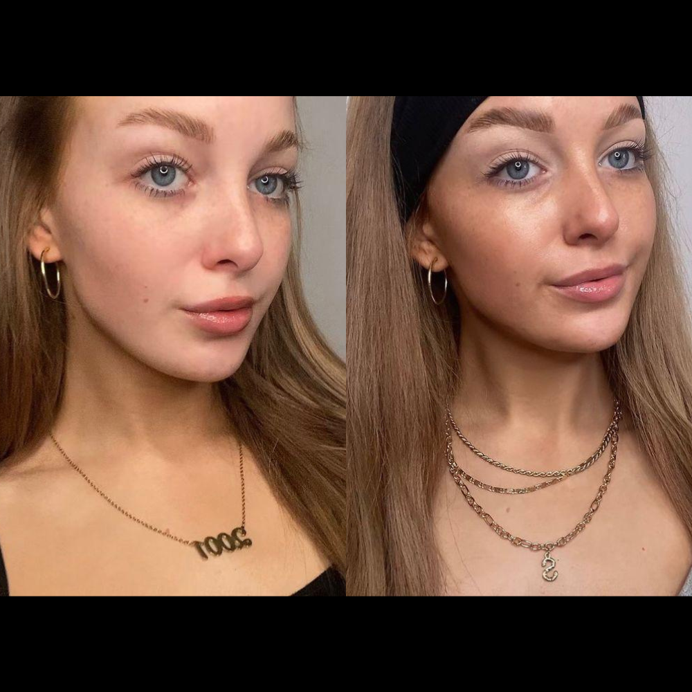 Skinny Tan Notox Drops Before and After results image